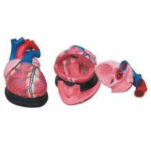 Enlarged Heart Model Simulation Medical Education